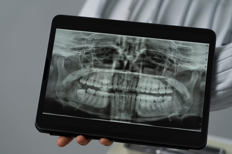 Radiologia Digitale